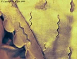 Bodice